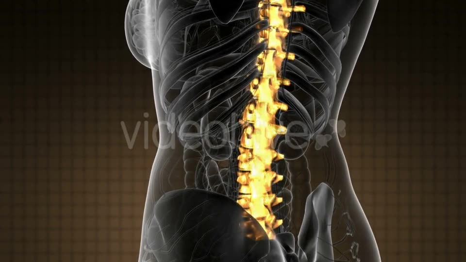 Backache in Back Bones - Download Videohive 21020704