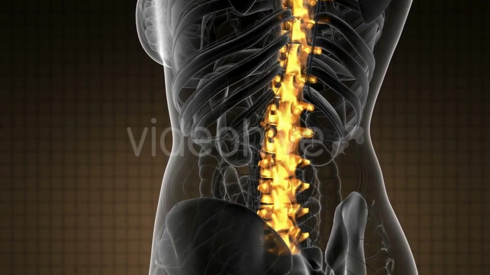 Backache in Back Bones - Download Videohive 21020704