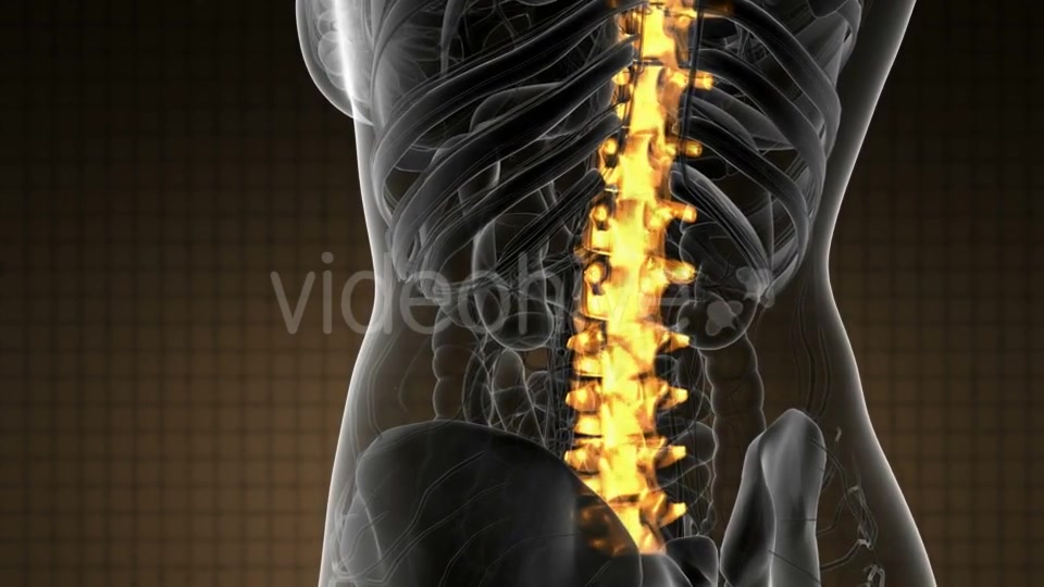 Backache in Back Bones - Download Videohive 21020704