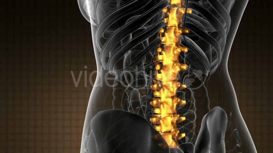 Backache in Back Bones - Download Videohive 21020704