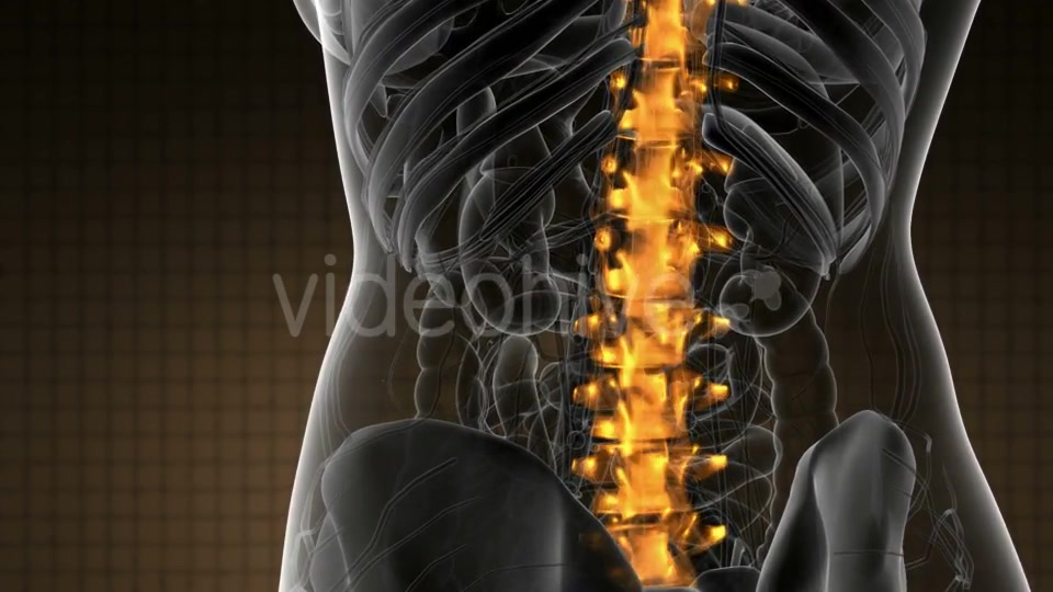 Backache in Back Bones - Download Videohive 21020704