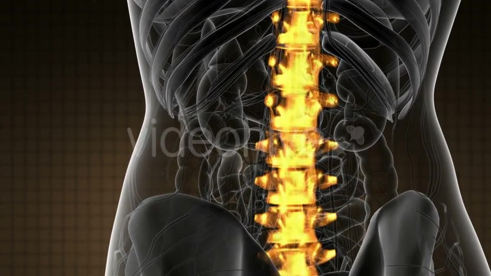 Backache in Back Bones - Download Videohive 21020704