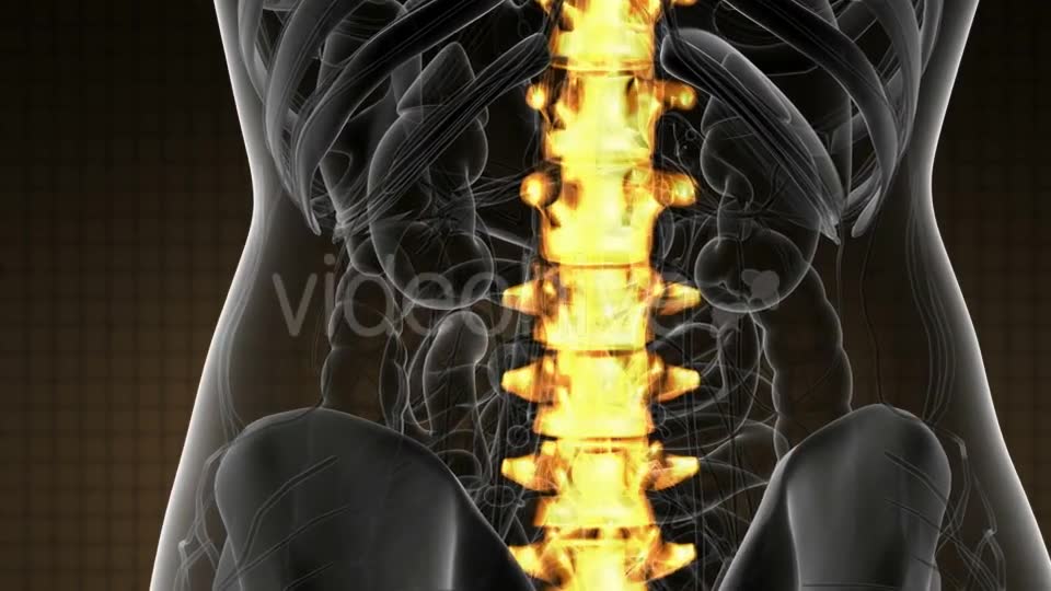 Backache in Back Bones - Download Videohive 21020704