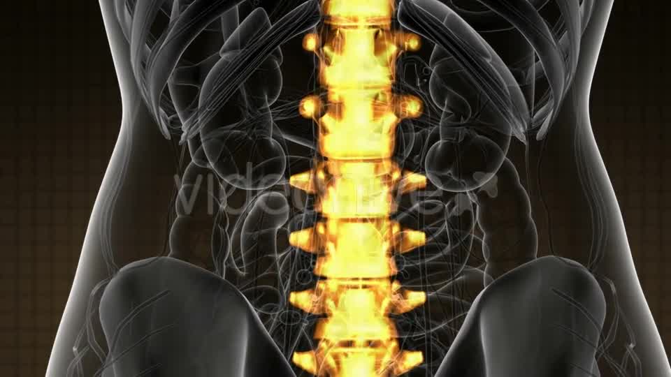 Backache in Back Bones - Download Videohive 21020704