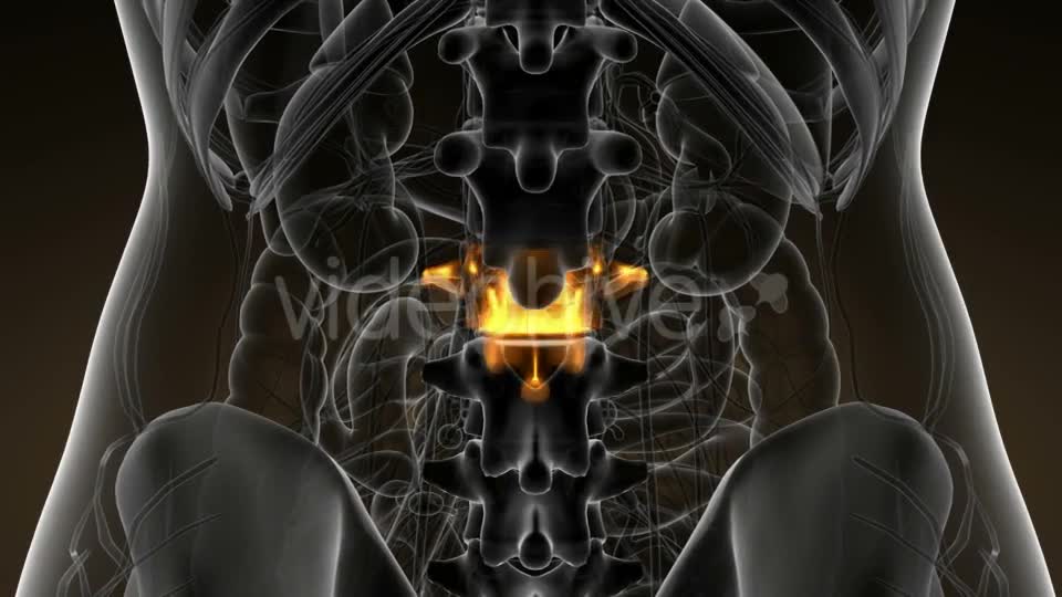 Backache in Back Bones - Download Videohive 21142759