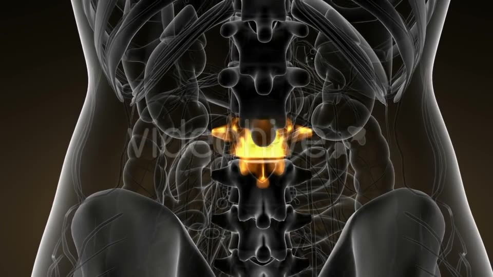 Backache in Back Bones - Download Videohive 21142759