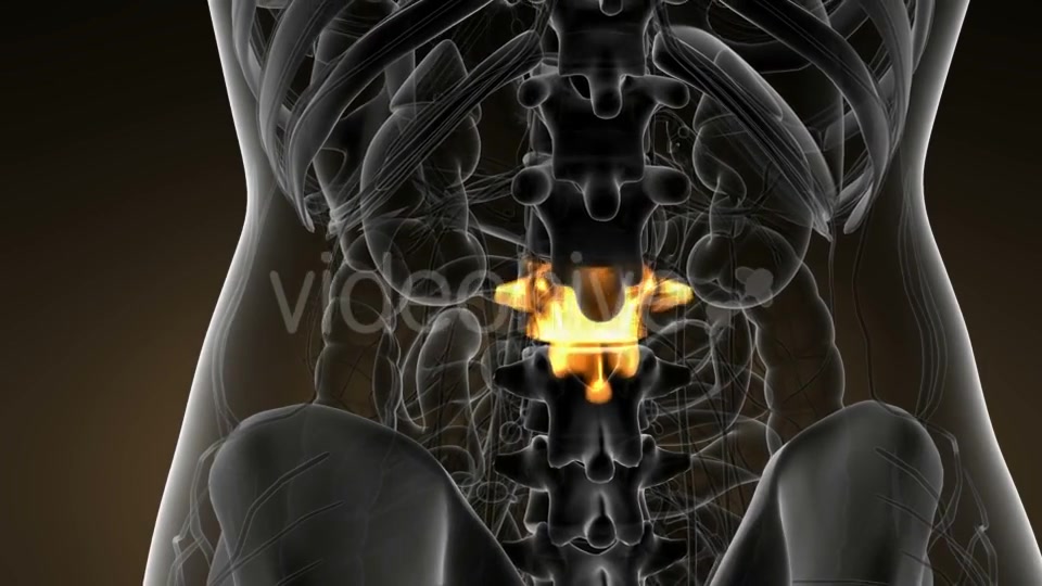 Backache in Back Bones - Download Videohive 21142759