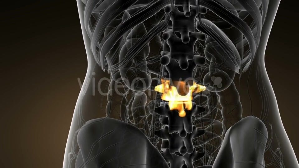 Backache in Back Bones - Download Videohive 21142759