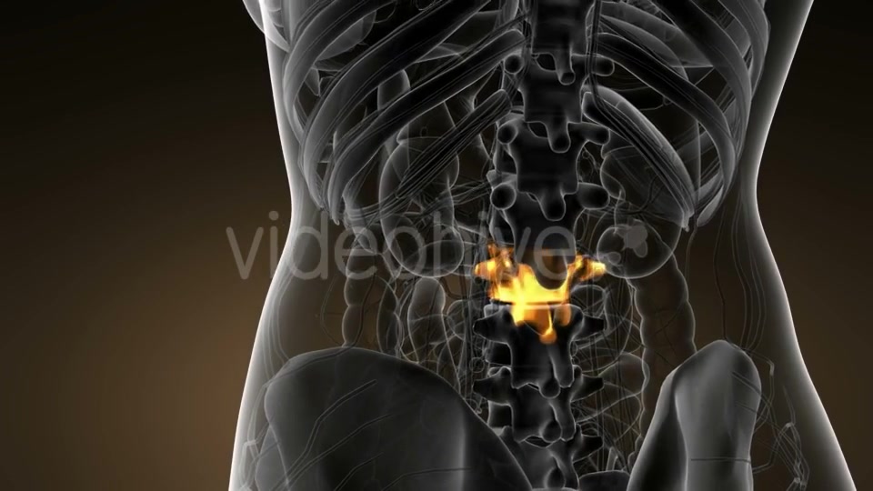 Backache in Back Bones - Download Videohive 21142759