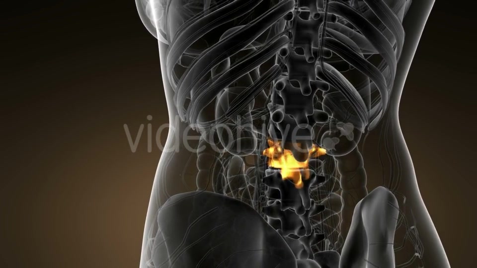 Backache in Back Bones - Download Videohive 21142759