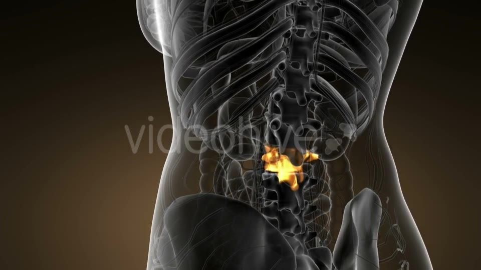 Backache in Back Bones - Download Videohive 21142759