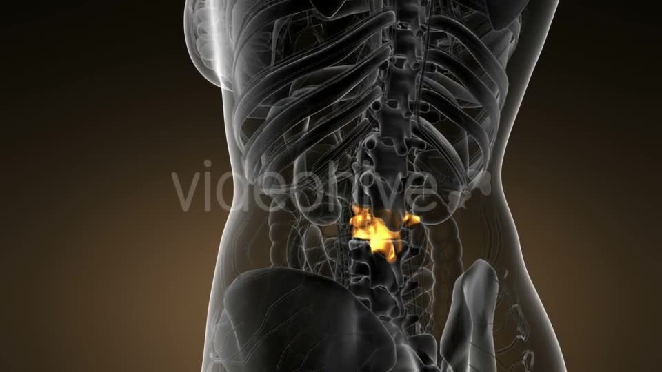 Backache in Back Bones - Download Videohive 21142759