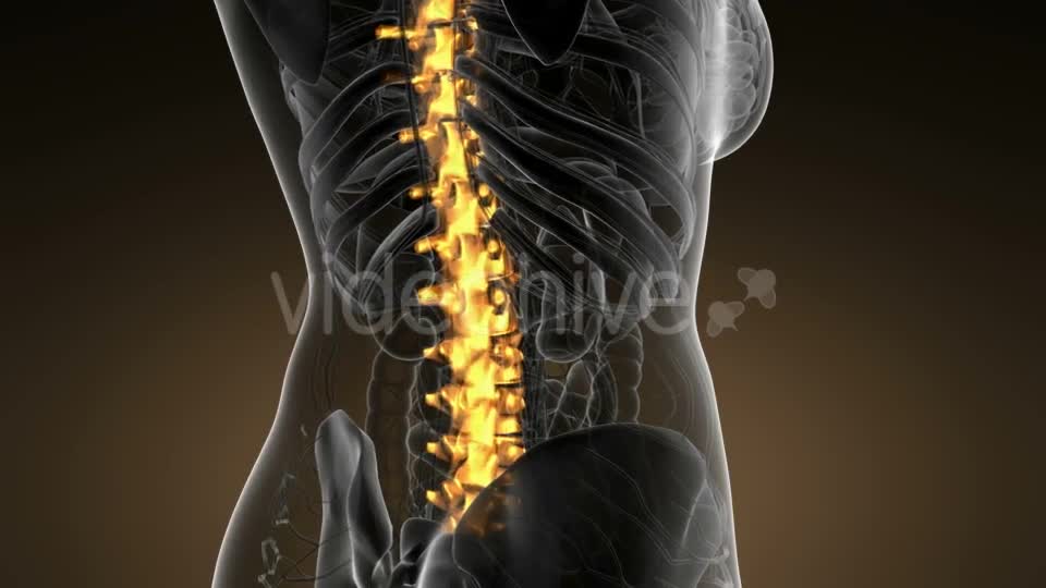 Backache in Back Bones - Download Videohive 21166511