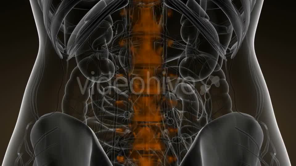 Backache in Back Bones - Download Videohive 21166511