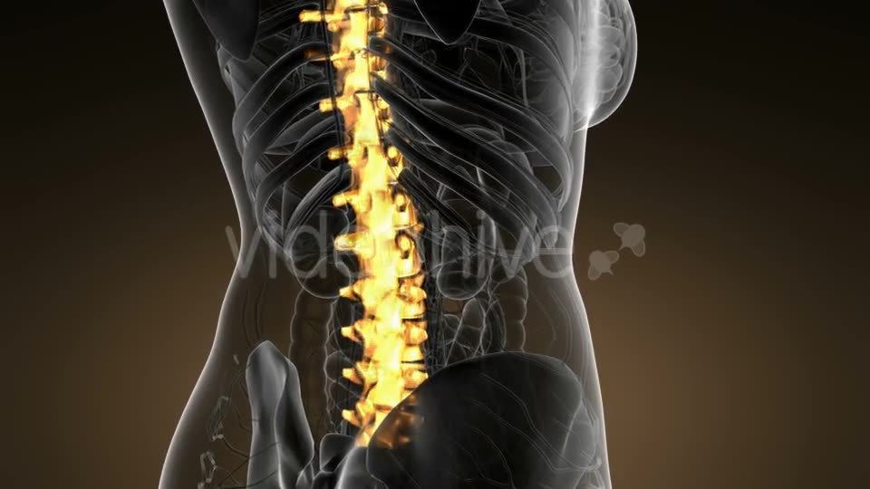 Backache in Back Bones - Download Videohive 21166511