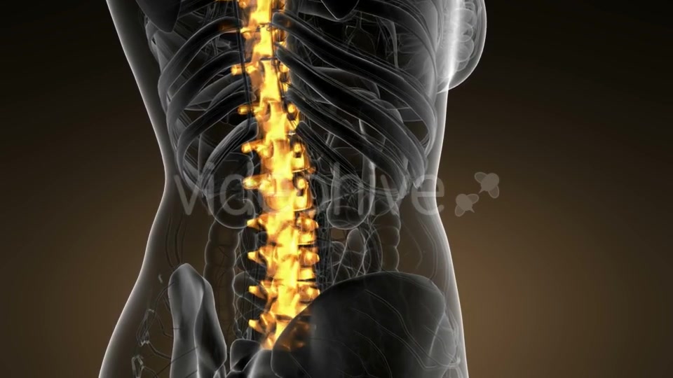 Backache in Back Bones - Download Videohive 21166511