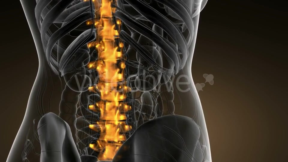 Backache in Back Bones - Download Videohive 21166511