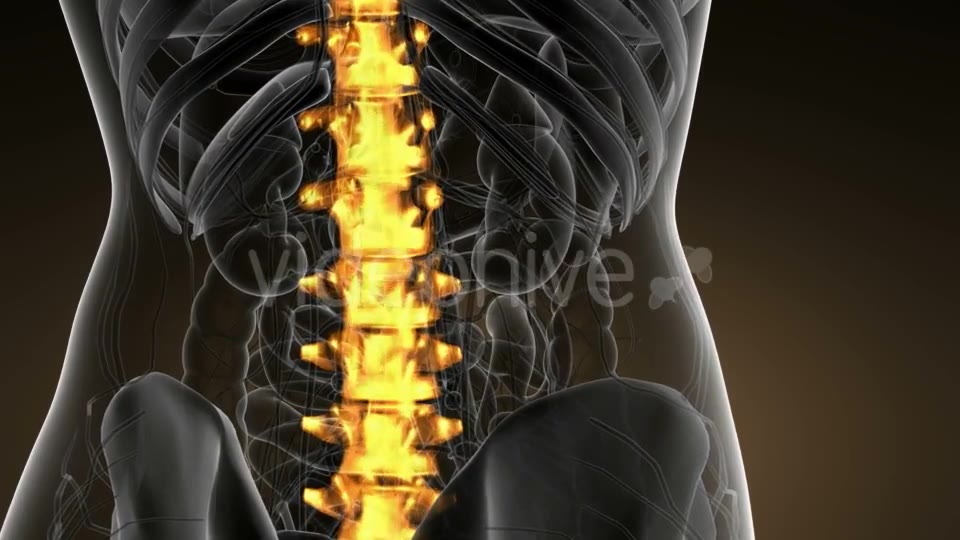 Backache in Back Bones - Download Videohive 21166511