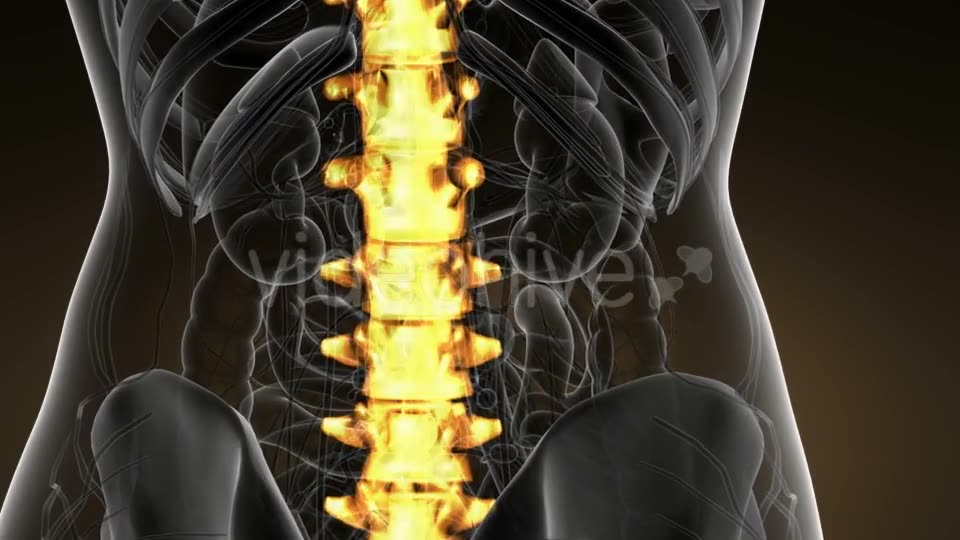 Backache in Back Bones - Download Videohive 21166511