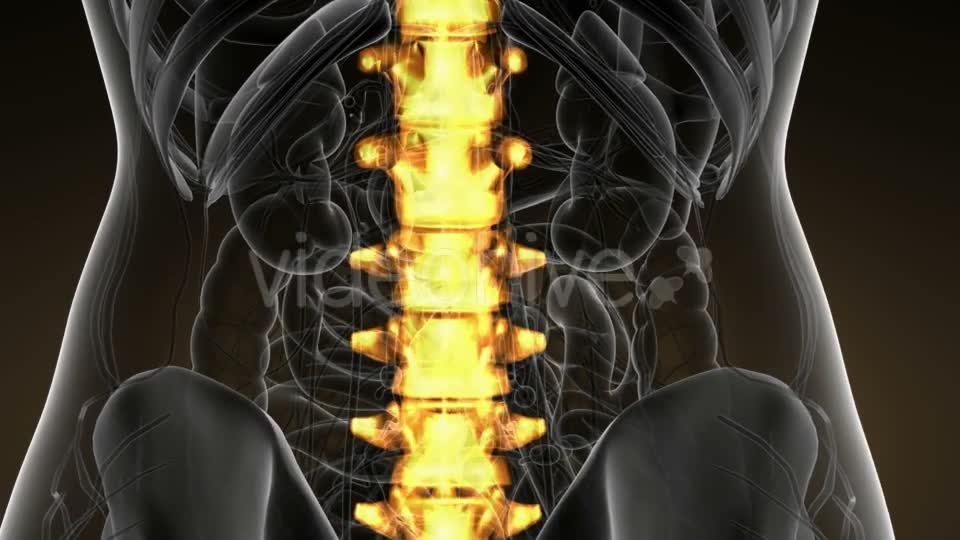 Backache in Back Bones - Download Videohive 21166511