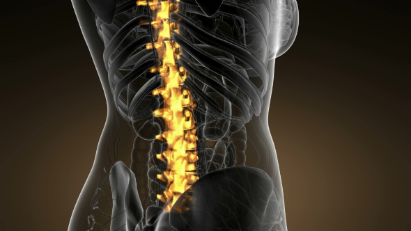 Backache in Back Bones - Download Videohive 21166511