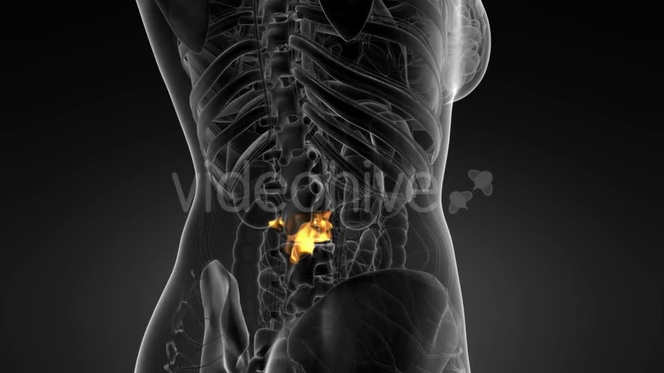 Backache in Back Bones - Download Videohive 21166522