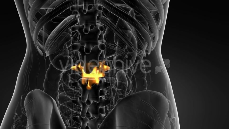 Backache in Back Bones - Download Videohive 21166522