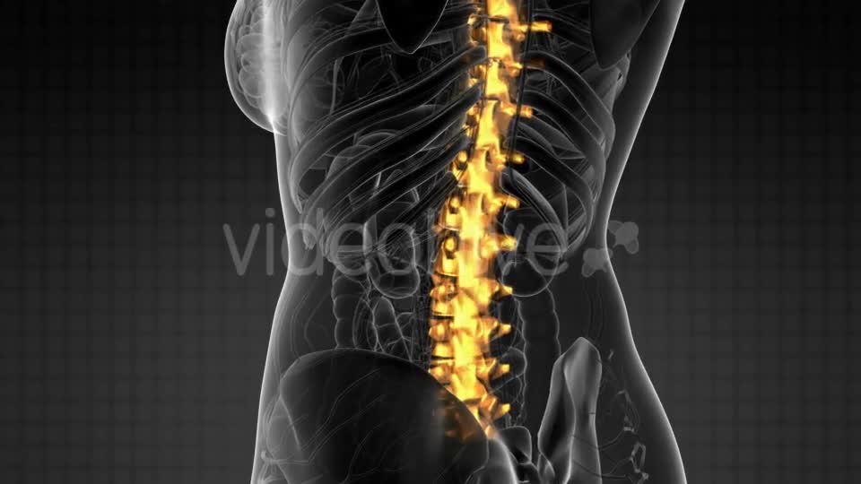 Backache in Back Bones - Download Videohive 21204758