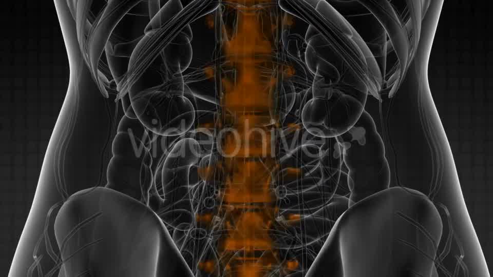 Backache in Back Bones - Download Videohive 21204758