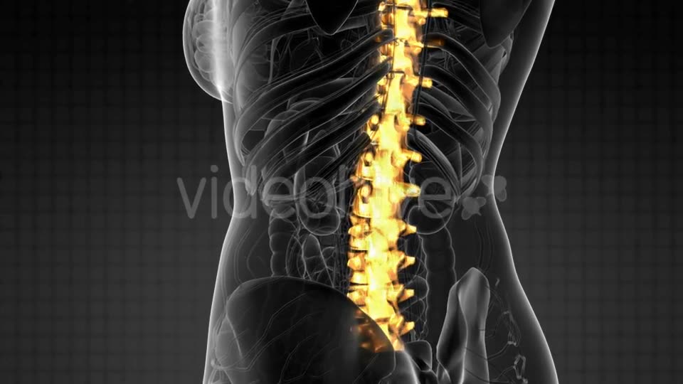 Backache in Back Bones - Download Videohive 21204758