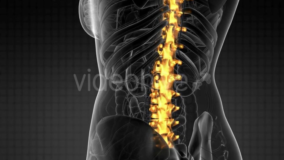 Backache in Back Bones - Download Videohive 21204758