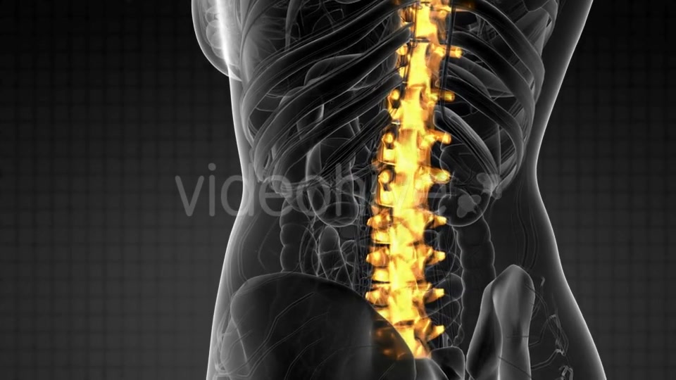 Backache in Back Bones - Download Videohive 21204758