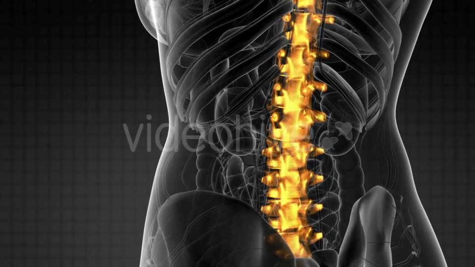 Backache in Back Bones - Download Videohive 21204758