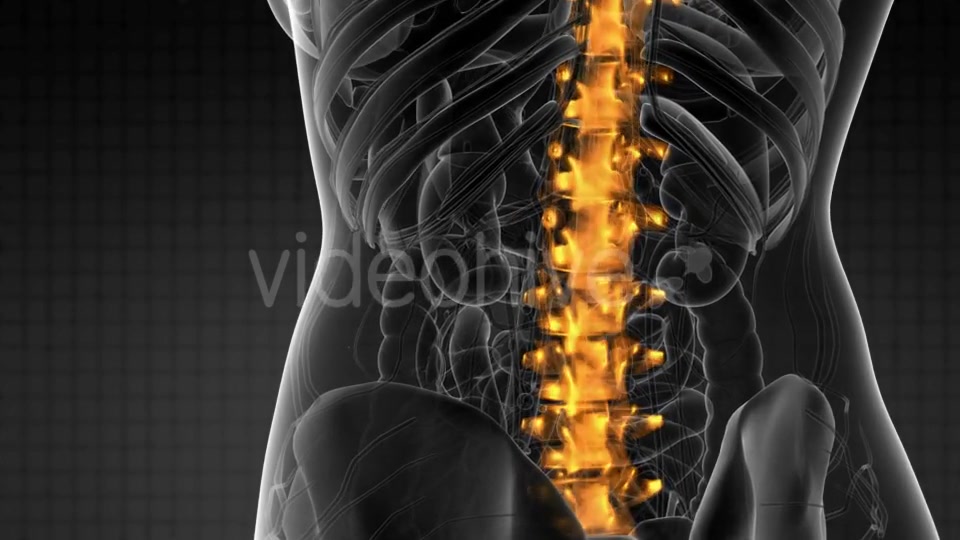 Backache in Back Bones - Download Videohive 21204758