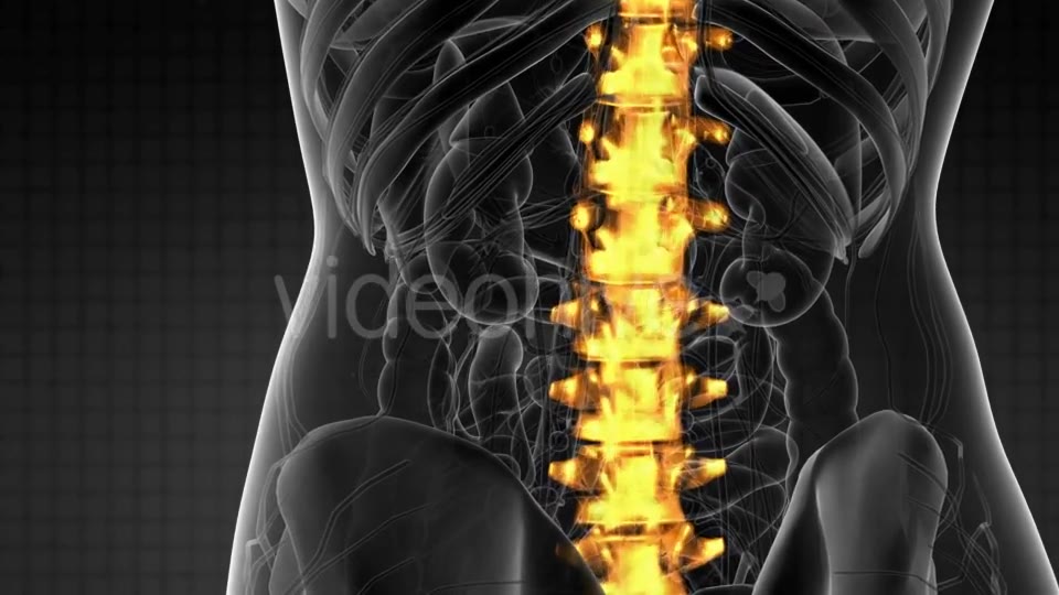 Backache in Back Bones - Download Videohive 21204758