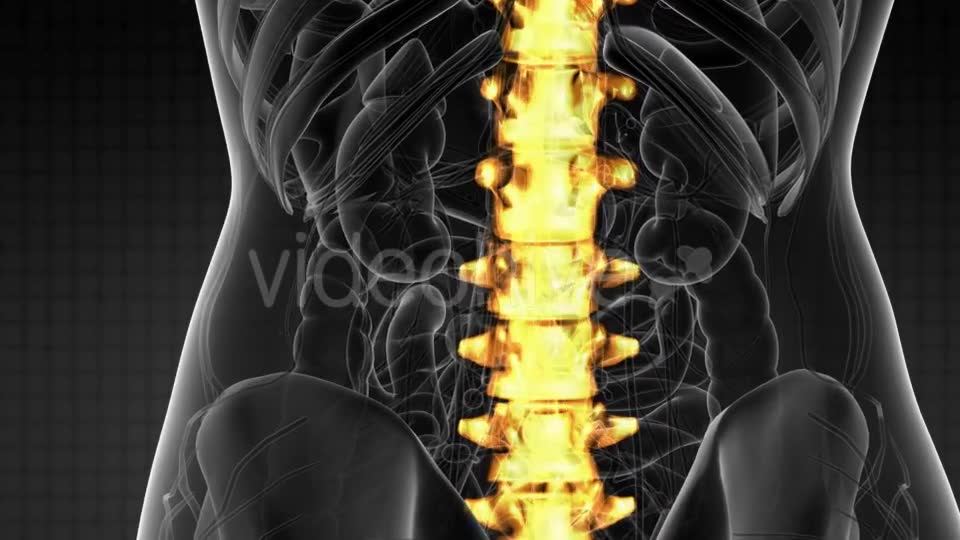 Backache in Back Bones - Download Videohive 21204758