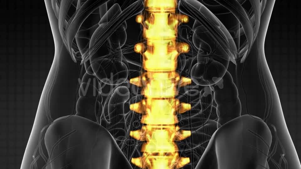 Backache in Back Bones - Download Videohive 21204758