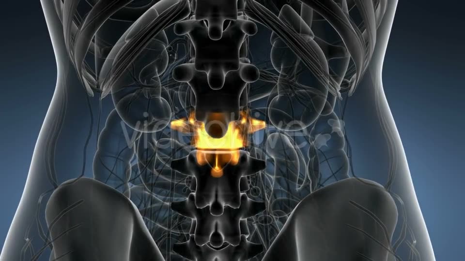 Backache in Back Bones - Download Videohive 21204967