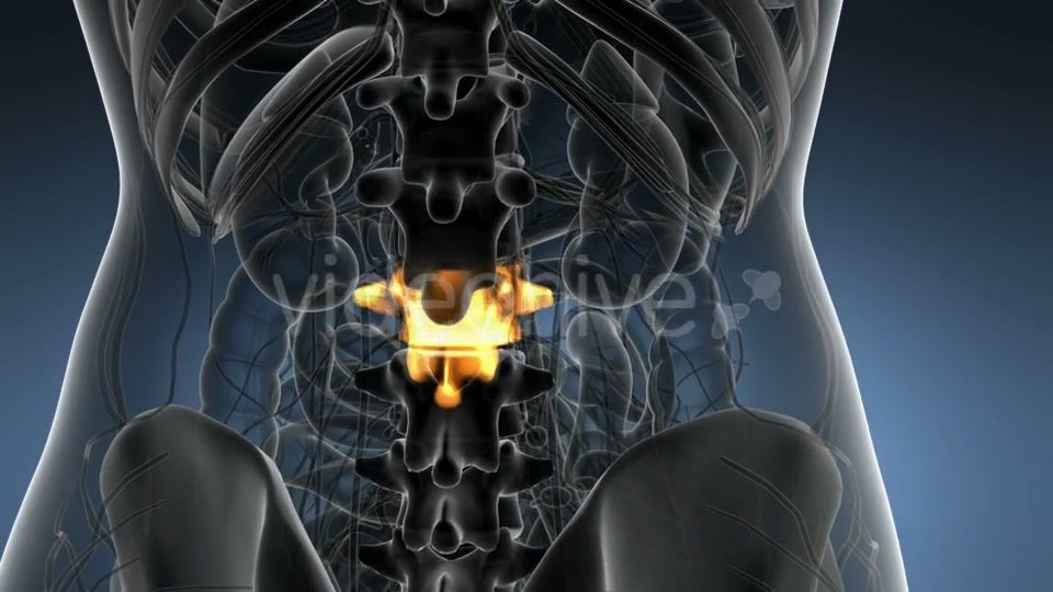 Backache in Back Bones - Download Videohive 21204967