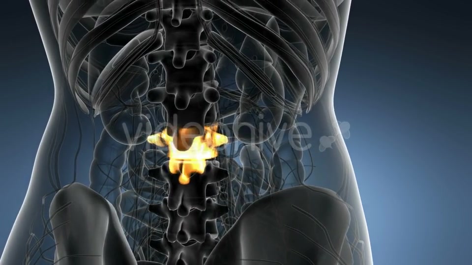 Backache in Back Bones - Download Videohive 21204967