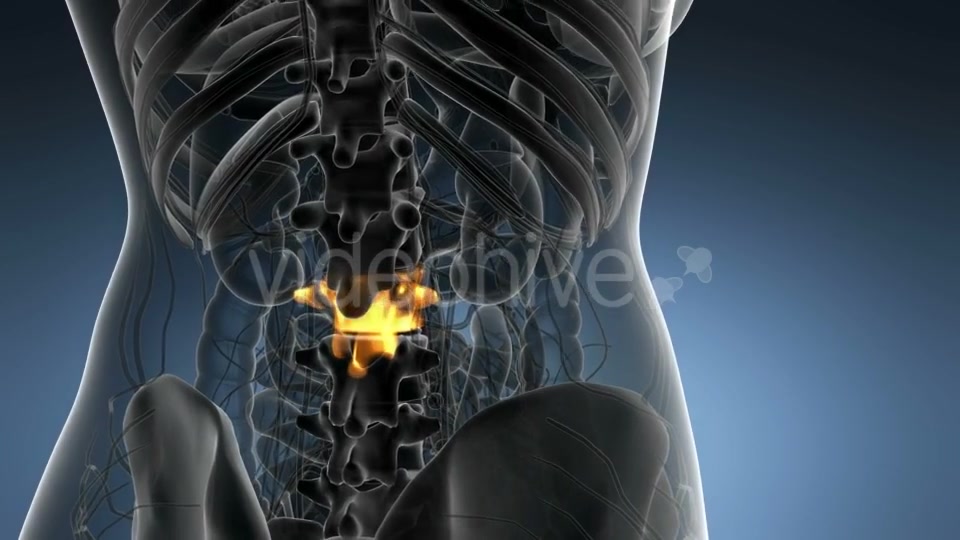 Backache in Back Bones - Download Videohive 21204967