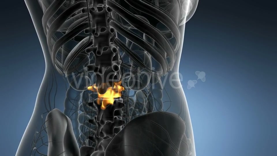 Backache in Back Bones - Download Videohive 21204967