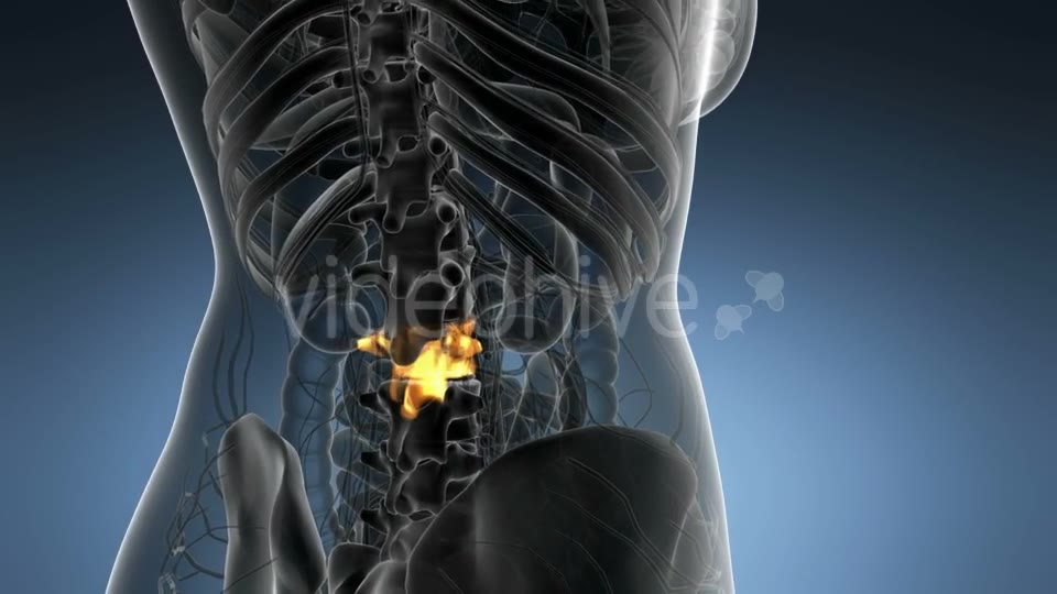 Backache in Back Bones - Download Videohive 21204967