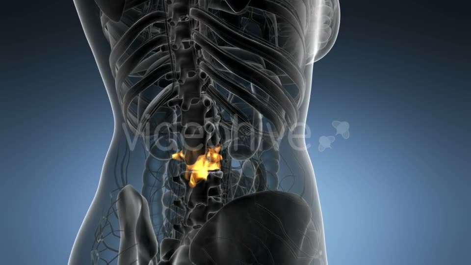 Backache in Back Bones - Download Videohive 21204967