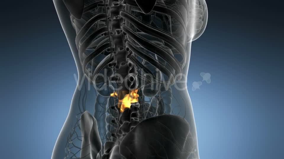 Backache in Back Bones - Download Videohive 21204967