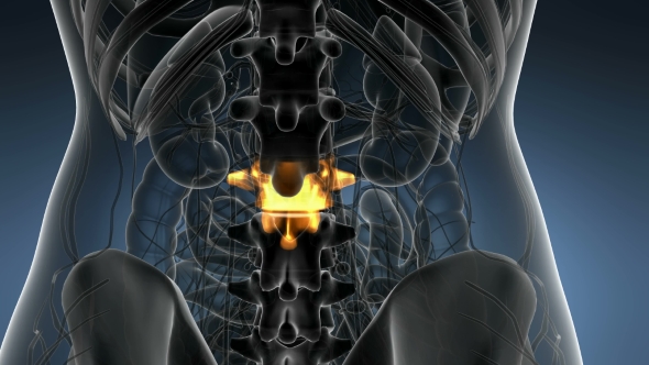 Backache in Back Bones - Download Videohive 21204967