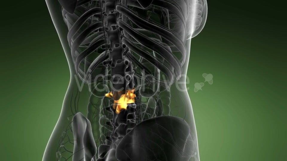 Backache in Back Bones - Download Videohive 21225220
