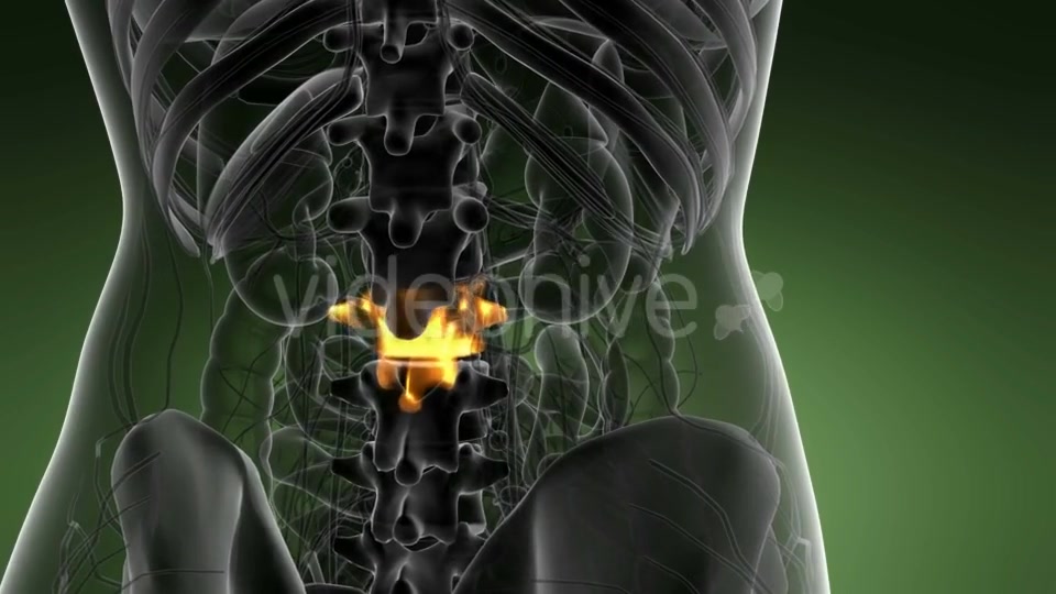 Backache in Back Bones - Download Videohive 21225220