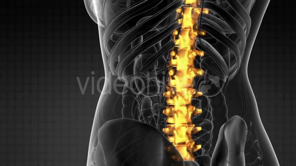 Backache in Back Bones - Download Videohive 21225268