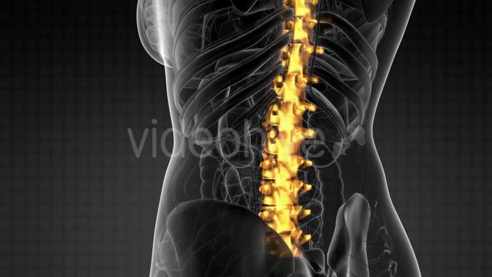 Backache in Back Bones - Download Videohive 21225268
